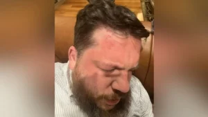 Navalny Supporter Leonid Volkov Assaulted in Lithuania