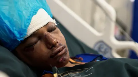Liam Weir/BBC News A girl lying on a hospital bed after an operation to remove shrapnel from her head